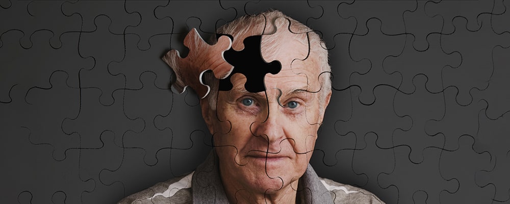 بیماری آلزایمر چیست؟علائم، علت، مراحل و درمان